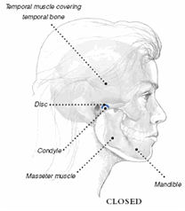 Description: Profile of closed mouth showing temporal muscle covering temporal bone, disc, condyle, masseter muscle and mandible